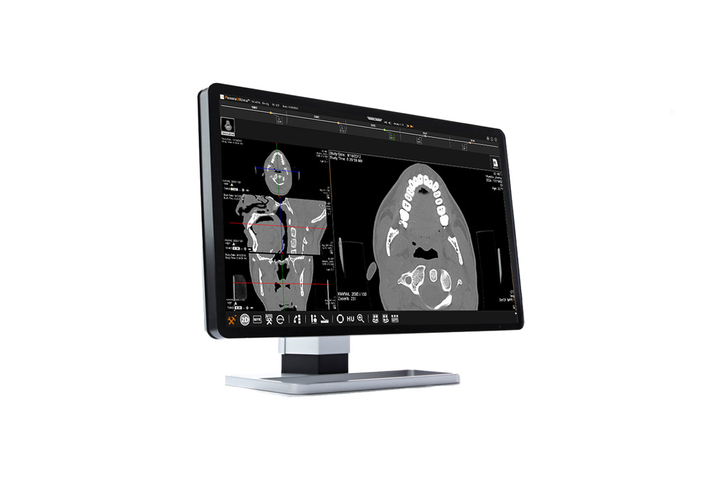 Dental Pacs Customizable Dental Charts