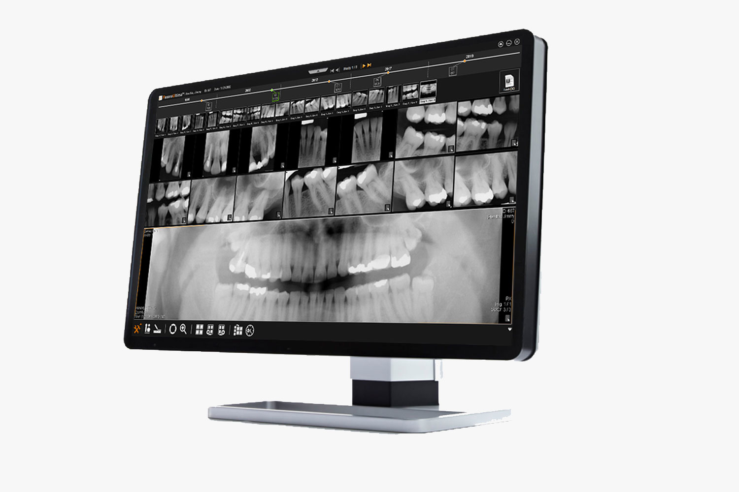 Dental Pacs FMX templates